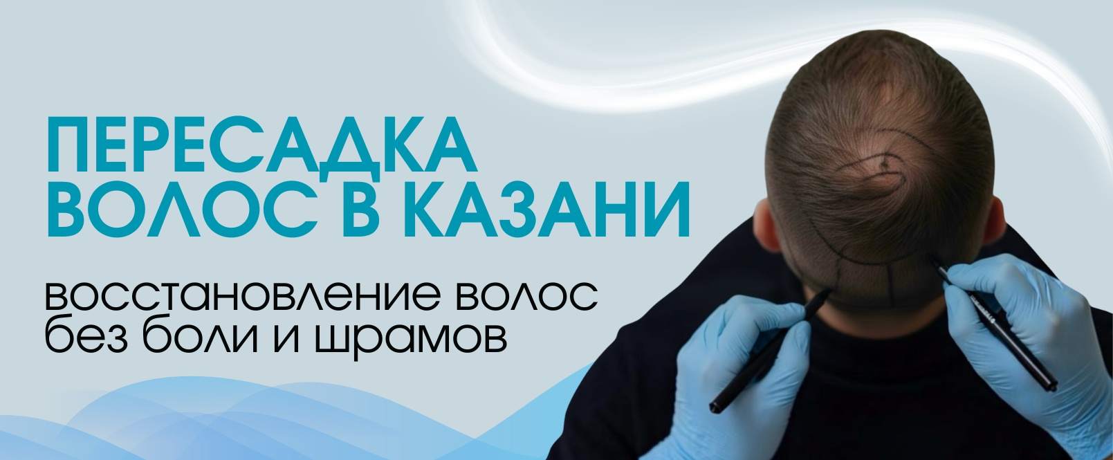 Пересадка волос в медицинском центре «Мадин» в Казани