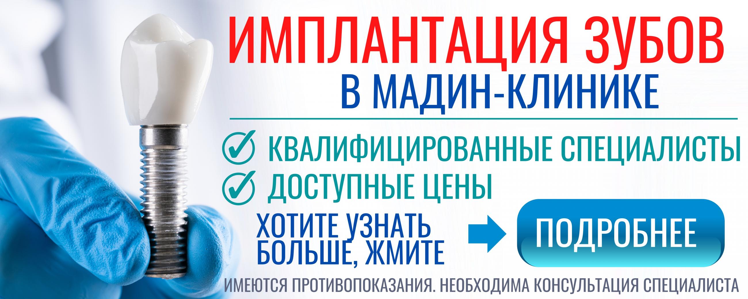 Имплант 52 отзывы. Имплант 52 Нижний Новгород.